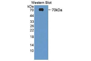 Western blot analysis of the recombinant protein. (HABP2 Antikörper  (AA 24-560))