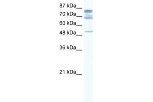 Western Blotting (WB) image for anti-DEAD (Asp-Glu-Ala-Asp) Box Polypeptide 46 (DDX46) antibody (ABIN2461582)