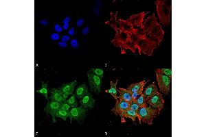Immunocytochemistry/Immunofluorescence analysis using Mouse Anti-Ataxin 1 Monoclonal Antibody, Clone S76-8 . (Ataxin 1 Antikörper  (AA 164-197) (Atto 594))