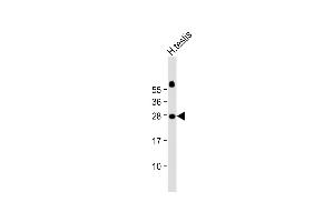 Anti-JAZF1 Antibody (C-Term) at 1:2000 dilution + Human testis lysate Lysates/proteins at 20 μg per lane. (JAZF1 Antikörper  (N-Term))