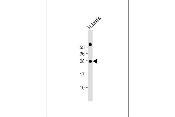 JAZF1 anticorps  (N-Term)