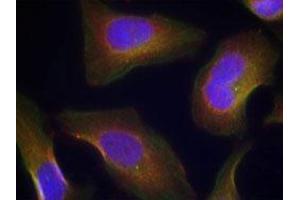 Immunofluorescent staining of methanol-fixed Hela cells using PRKCQ (phospho S676) polyclonal antibody  at 1:100-1:200 dilution. (PKC theta Antikörper  (pSer676))