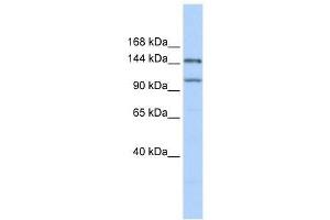 Western Blot showing PRDM9 antibody used at a concentration of 1. (PRDM9 Antikörper  (Middle Region))
