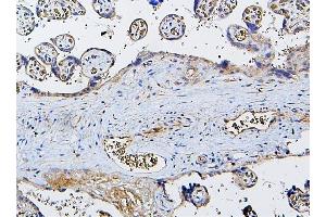 IHC analysis of CETP using anti-CETP antibody (ABIN7602439). (CETP Antikörper  (AA 77-353))