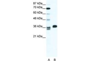 Western Blotting (WB) image for anti-ESX Homeobox 1 (ESX1) antibody (ABIN2461319) (ESX Homeobox 1 Antikörper)