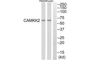 Western blot analysis of extracts from HuvEc cells and HepG2 cells, using CAMKK2 antibody.