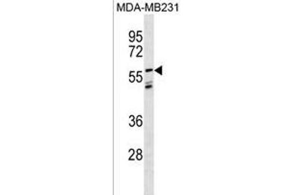 LGI3 anticorps  (AA 310-338)