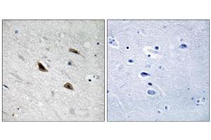 Immunohistochemistry analysis of paraffin-embedded human brain tissue using Catenin- beta (Phospho-Tyr489) antibody. (beta Catenin Antikörper  (pTyr489))