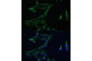 Immunofluorescence analysis of C6 cells using  Polyclonal Antibody (ABIN7265493) at dilution of 1:100 (40x lens). (ARL3 Antikörper  (AA 1-182))