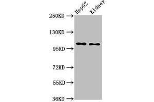 Western Blot Positive WB detected in: HepG2 whole cell lysate, Rat kidney tissue All lanes: PCSK5 antibody at 6 μg/mL Secondary Goat polyclonal to rabbit IgG at 1/50000 dilution Predicted band size: 207, 102 kDa Observed band size: 102 kDa (PCSK5 Antikörper  (AA 201-500))