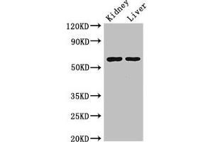 Western Blot Positive WB detected in: Mouse kidney tissue, Mouse liver tissue All lanes: ALDH6A1 antibody at 2. (ALDH6A1 Antikörper  (AA 274-399))