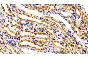 Detection of FEz2 in Rat Kidney Tissue using Polyclonal Antibody to Fasciculation And Elongation Protein Zeta 2 (FEz2) (FEZ2 Antikörper  (AA 1-375))