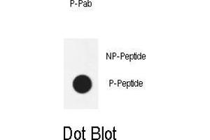 Dot blot analysis of anti-Phospho-AKT1- Antibody Phospho-specific Pab (ABIN650890 and ABIN2839832) on nitrocellulose membrane. (AKT1 Antikörper  (pThr450))