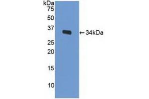 Detection of Recombinant LRP1, Mouse using Polyclonal Antibody to Low Density Lipoprotein Receptor Related Protein 1 (LRP1) (LRP1 Antikörper  (AA 692-962))