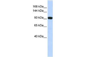 WB Suggested Anti-EVI1 Antibody Titration: 0. (MECOM Antikörper  (Middle Region))
