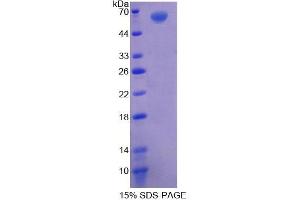 SDS-PAGE analysis of Human AGK Protein. (Acylglycerol Kinase Protein (AGK))