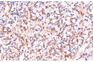 Immunohistochemistry of paraffin-embedded Human tonsil using IKK alpha Polyclonal Antibody at dilution of 1:100 (40x lens). (IKK alpha Antikörper)