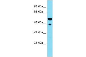 Host: Rabbit  Target Name: St13  Sample Tissue: Mouse Heart lysates  Antibody Dilution: 1. (HSC70 Interacting Protein HIP Antikörper  (N-Term))