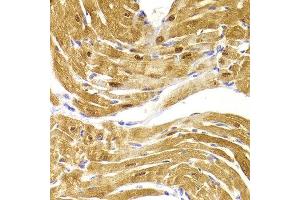 Immunohistochemistry of paraffin-embedded Mouse heart using CSRP3 antibody at dilution of 1:100 (x400 lens). (CSRP3 Antikörper)