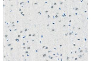 ABIN6257957 and ABIN6275973 at 1/100 staining Rat brain tissue by IHC-P. (BAI1 Antikörper  (Internal Region))