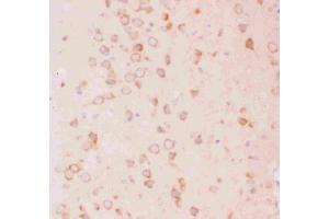 Immunohistochemistry (IHC) image for anti-Tuberous Sclerosis 2 (TSC2) (AA 1611-1807) antibody (ABIN3043498)