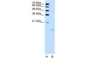 Western Blotting (WB) image for anti-Acid Phosphatase 1, Soluble (ACP1) antibody (ABIN2462541) (ACP1 Antikörper)
