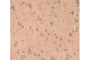 Used in DAB staining on fromalin fixed paraffin- embedded brain tissue (ARTN Antikörper)