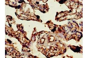 Immunohistochemistry of paraffin-embedded human placenta tissue using ABIN7144564 at dilution of 1:100 (ARAP1 Antikörper  (AA 69-344))