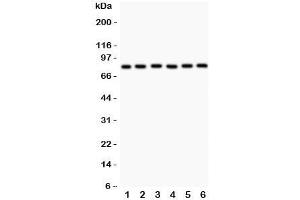 Western blot testing of MFN1 antibody and Lane 1:  rat heart;  2: (r) kidney;  3: mouset heart;  4: human HeLa;  5: (h) COLO320;  6: (h) A549.