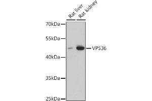 Western blot analysis of extracts of various cell lines, using VPS36 antibody (ABIN7271277) at 1:3000 dilution. (VPS36 Antikörper  (AA 70-220))