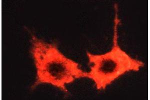 ABIN6269062 staining MCF-7 cells by ICC/IF. (JAK2 Antikörper  (Internal Region))