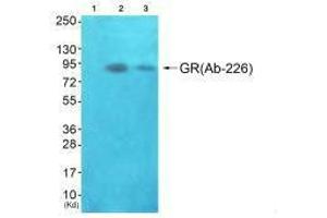 Western blot analysis of extracts from JK cells (Lane 2) and K562 cells (Lane 3), using GR(Ab-226) antiobdy. (Glucocorticoid Receptor Antikörper  (Ser226, Ser234, Ser246))
