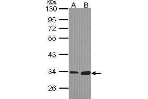 WB Image Sample (30 ug of whole cell lysate) A: Hela B: Hep G2 , 10% SDS PAGE antibody diluted at 1:1000 (MGLL Antikörper)