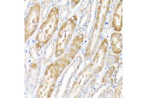 Immunohistochemistry of paraffin-embedded mouse kidney using IKBKAP Rabbit pAb (ABIN6130369, ABIN6142278, ABIN6142279 and ABIN6214265) at dilution of 1:100 (40x lens). (IKAP/p150 Antikörper  (AA 1093-1332))
