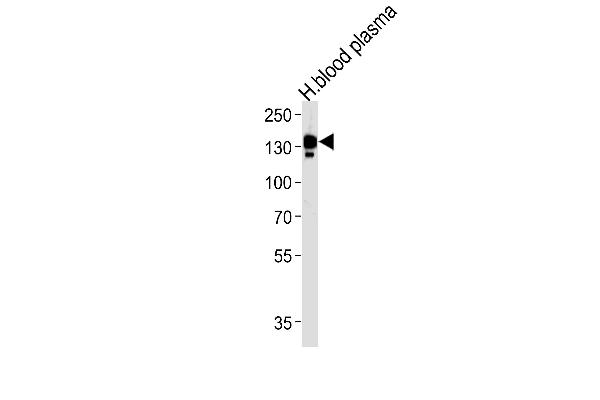 Ceruloplasmin Antikörper  (N-Term)