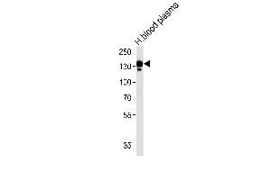 CP Antibody (N-term) (ABIN391512 and ABIN2841473) western blot analysis in human blood plasma tissue lysates (35 μg/lane). (Ceruloplasmin Antikörper  (N-Term))