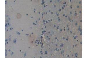 Detection of REG3b in Mouse Cerebrum Tissue using Polyclonal Antibody to Regenerating Islet Derived Protein 3 Beta (REG3b) (REG3B Antikörper  (AA 27-175))