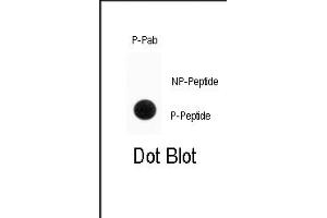 Dot blot analysis of anti-Phospho-ENT1(Slc29a1)-p Antibody (ABIN389998 and ABIN2839775) on nitrocellulose membrane. (SLC29A1 Antikörper  (pSer254))