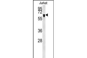 BTBD9 Antibody (Center) (ABIN651859 and ABIN2840426) western blot analysis in Jurkat cell line lysates (15 μg/lane). (BTBD9 Antikörper  (AA 237-262))