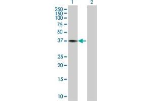Western Blot analysis of CTSK expression in transfected 293T cell line by CTSK MaxPab polyclonal antibody. (Cathepsin K Antikörper  (AA 1-329))
