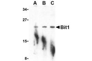 Western blot analysis of Bit1 in A-20 cell lysate with AP30152PU-N Bit1 antibody at (A) 1, (B) 2, and (C) 4 μg/ml. (PTRH2 Antikörper  (N-Term))