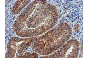 Image no. 6 for anti-Mannose Phosphate Isomerase (MPI) antibody (ABIN1499545) (MPI Antikörper)