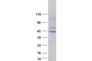 Validation with Western Blot (TFB2M Protein (Myc-DYKDDDDK Tag))
