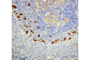 Anti-SOCS1 antibody, IHC(P) IHC(P): Rat Spleen Tissue