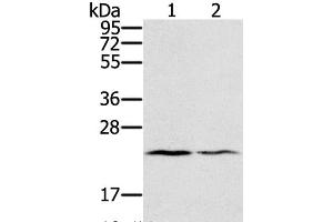 Western Blot analysis of Human normal right lung and normal left lung tissue using EDN2 Polyclonal Antibody at dilution of 1:600 (Endothelin 2 Antikörper)