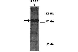 Lanes :  Lane 1: 10ug mouse ATN2 transfected Drosophila extract   Primary Antibody Dilution :   1:100    Secondary Antibody :  Anti-rabbit-HRP   Secondary Antibody Dilution :   1:2000   Gene Name :  RERE   Submitted by :  Manolis Fanto, King's College London (RERE Antikörper  (N-Term))