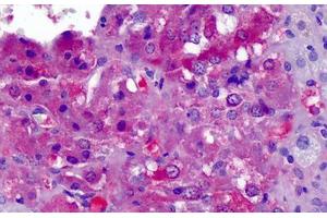Human Adrenal: Formalin-Fixed, Paraffin-Embedded (FFPE) (APOA2 Antikörper  (AA 1-100))