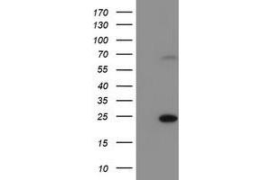 Western Blotting (WB) image for anti-SAYSVFN Motif Domain Containing 1 (SAYSD1) antibody (ABIN1497059) (SAYSD1 Antikörper)