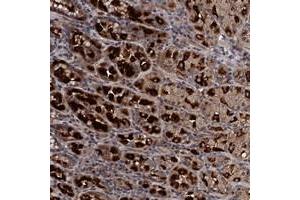 Immunohistochemical staining of human stomach with ADAMTS10 polyclonal antibody  shows strong cytoplasmic positivity in glandular cells at 1:10-1:20 dilution.