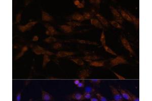 Immunofluorescence analysis of C6 cells using CD44 Polyclonal Antibody at dilution of 1:100. (CD44 Antikörper)